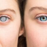 Seeing Clearly: What to Expect Before, During, and After Cataract Surgery